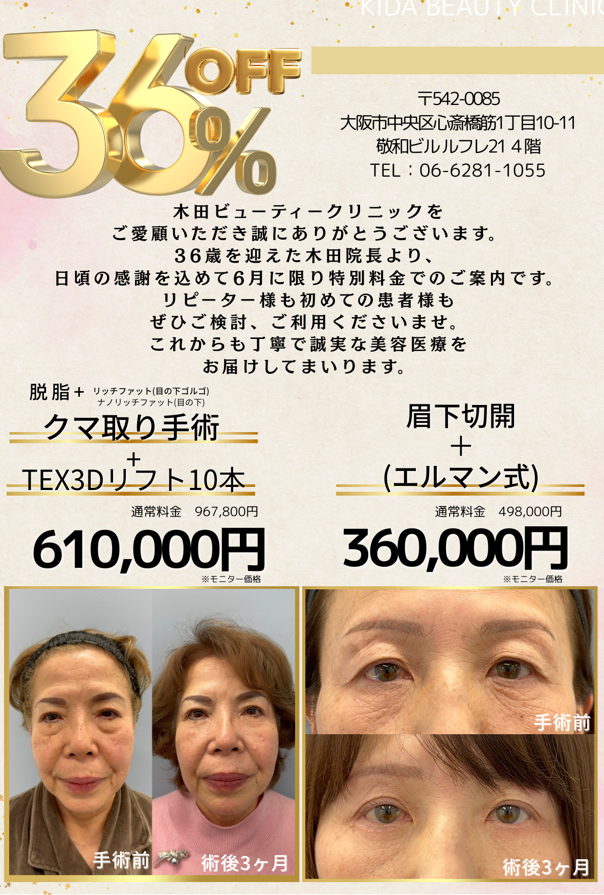大阪 クマ取り,大阪 クマ治療,大阪 裏ハムラ,大阪 脂肪注入,クマ取りダウンタイム,クマ取り 大阪,クマ治療 大阪,裏ハムラ 大阪,脂肪注入 大阪,クマ取り,クマ治療,裏ハムラ,脂肪注入,ダウンタイム,大阪,心斎橋,専門院,美容外科,木田ビューティークリニック